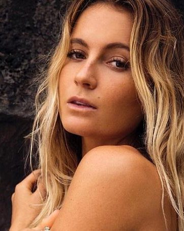 alana blanchard