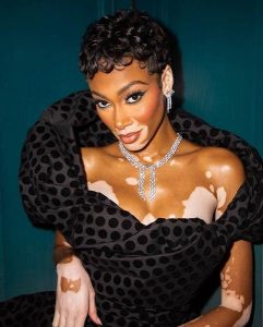 winnie harlow