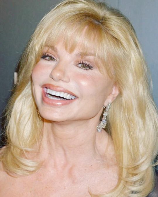 Loni Anderson 1 loni anderson